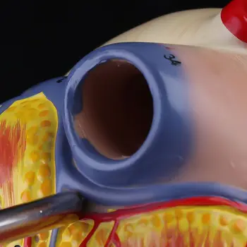 Razstavljeno Anatomski Človeško Srce Model Anatomijo Medicinske Viscera Organov Medicinske Dropship